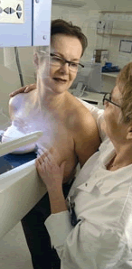 mammografi