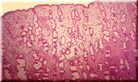 Endometrium